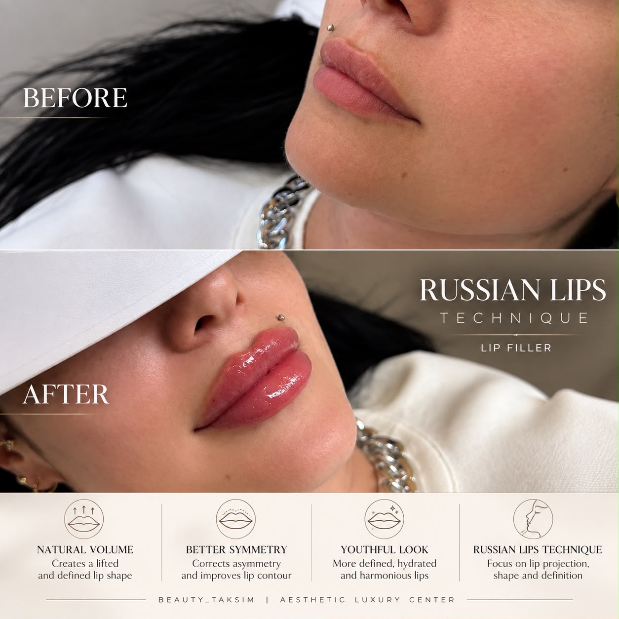 Treatment photo 21