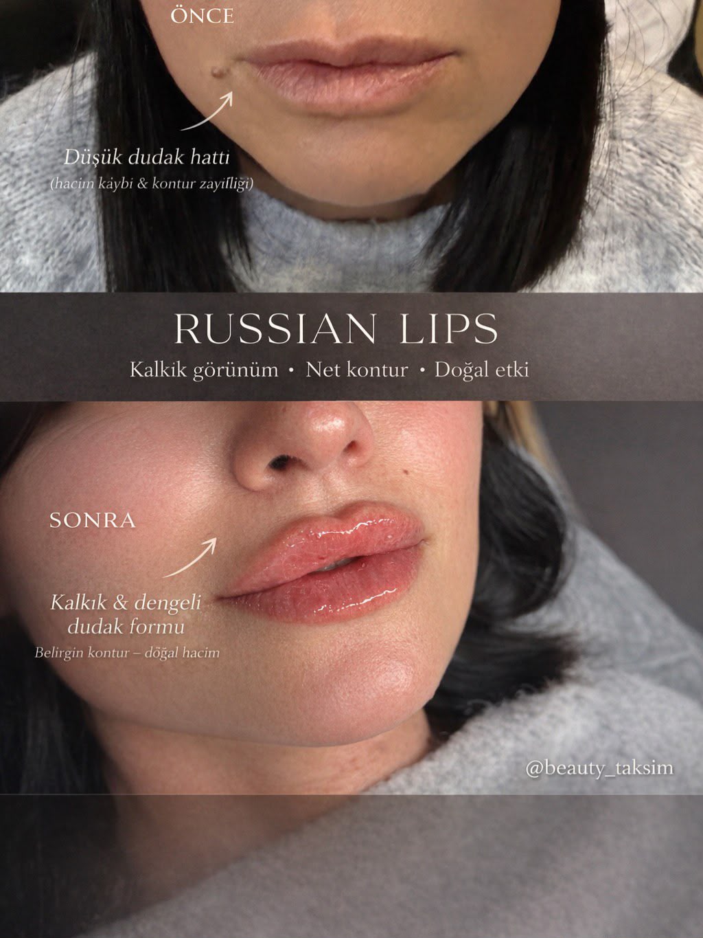 Treatment photo 7
